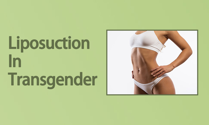 Liposuction In Transgender