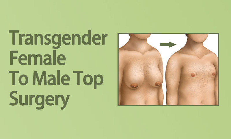 Transgender Female To Top Surgery