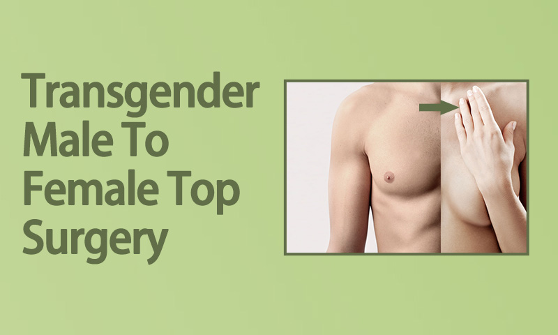 Transgender Male To Female Top Surgery