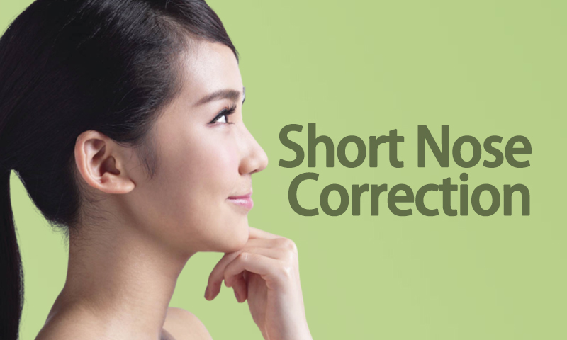 Short Nose Correction