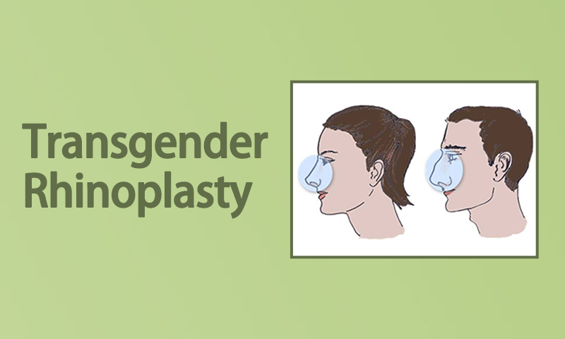Transgender Rhinoplasty