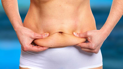 Tummy Fat Removal without Surgery