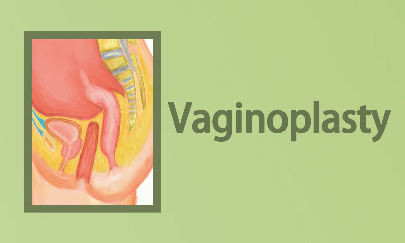 Vaginoplasty