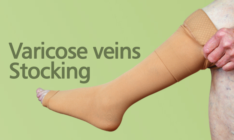 Varicose Veins Stocking