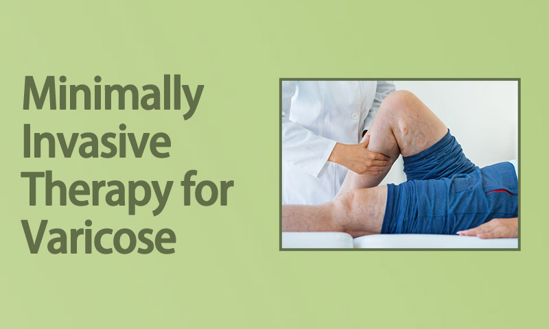 Minimally Invasive Therapy for Varicose