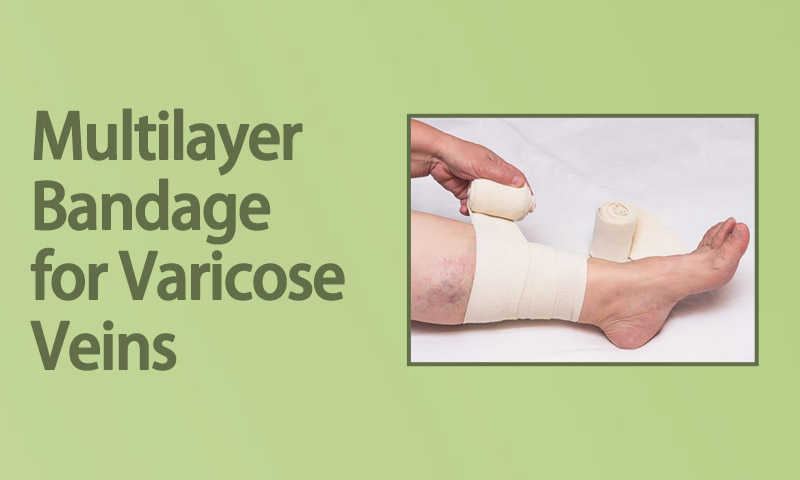 Multilayer Bandage for Varicose Veins