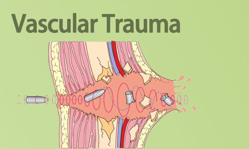 Vascular Trauma