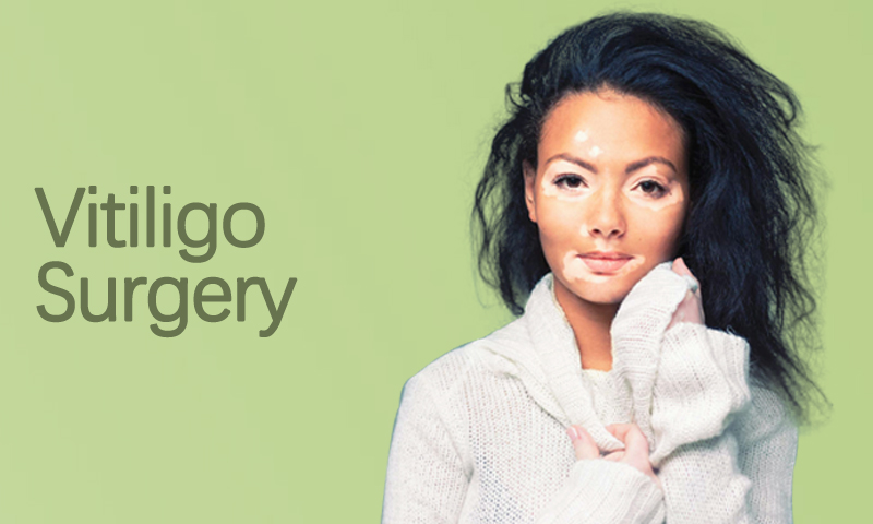 Vitiligo Surgery in Surat, Gujarat (India)